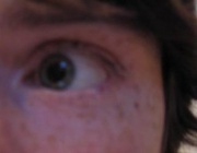 My left eye